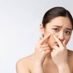 6 Cara Menghilangkan Jerawat